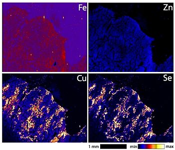 Synchrotron x-ray (XFM) image shows the distribution of selenium and copper in the kidney of a rodent fed a high selenium diet.