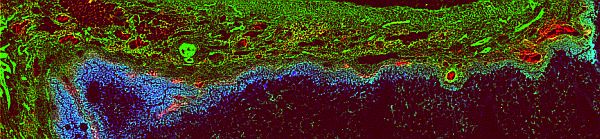 XFM image of follicle, showing zinc, iron and selenium