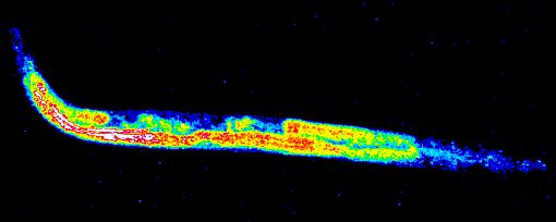 Synchrotron map of zinc distribution in roundworm